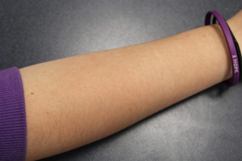 There are many downsides to shaving your arms. Only some of the consequences include skin irritation, ingrown hairs, razor burn, or even folliculitis, which results from irritated skin.